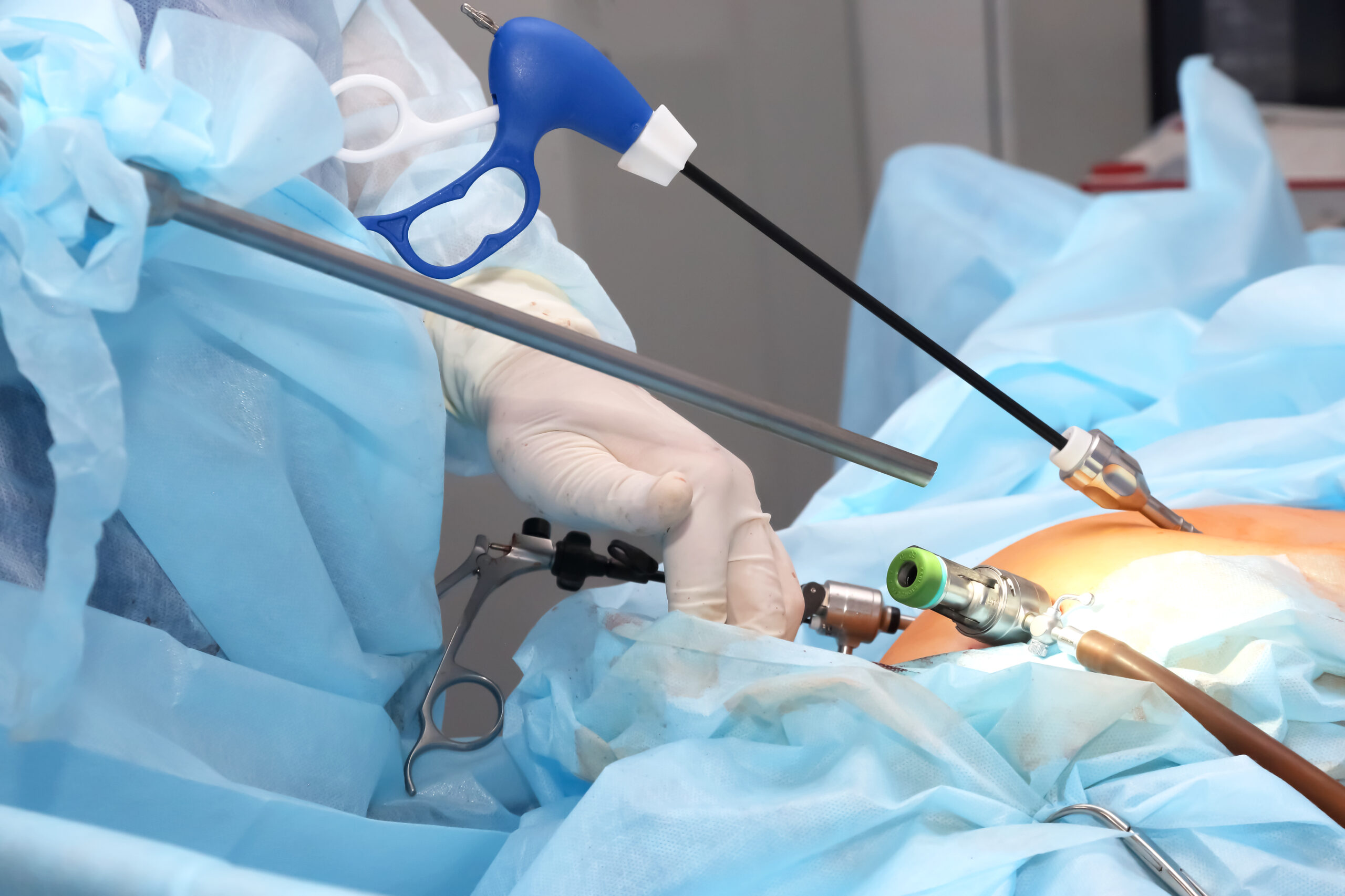 Best Gynae Laparoscopic Surgeon in Old Palasia, Indore
